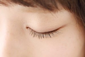 Can I Please Be Put To Sleep During LASIK Surgery?