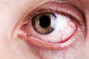 Eye Capillaries