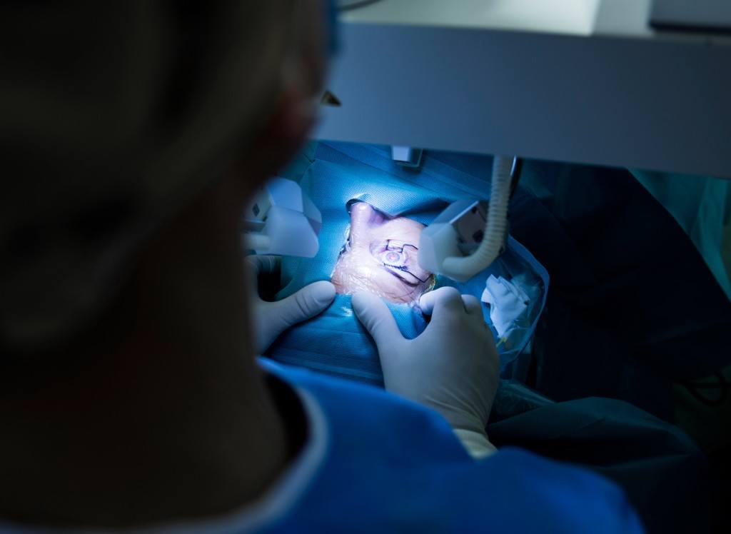 LASIK eye surgery procedure